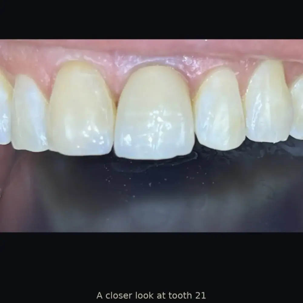 Ansarian Dental Clinic، عکس 2 از اینستاگرام