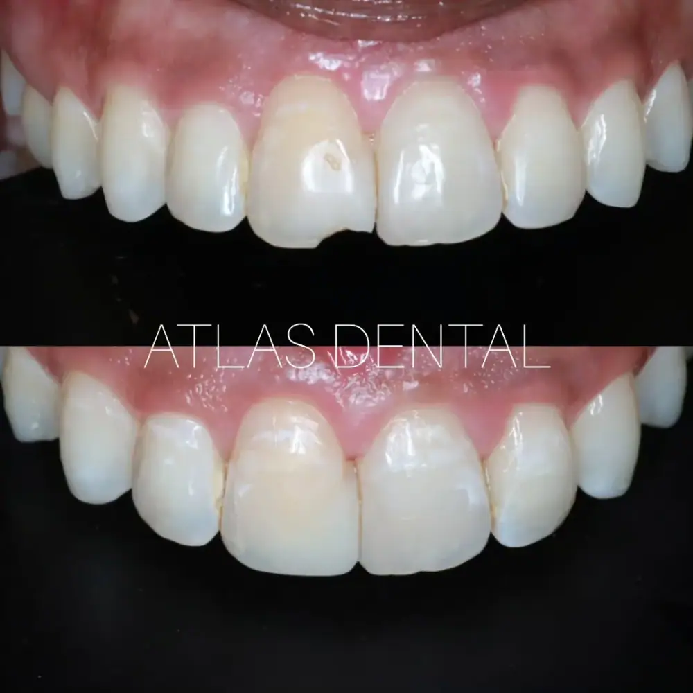 Atlas Dental، عکس 4 از اینستاگرام