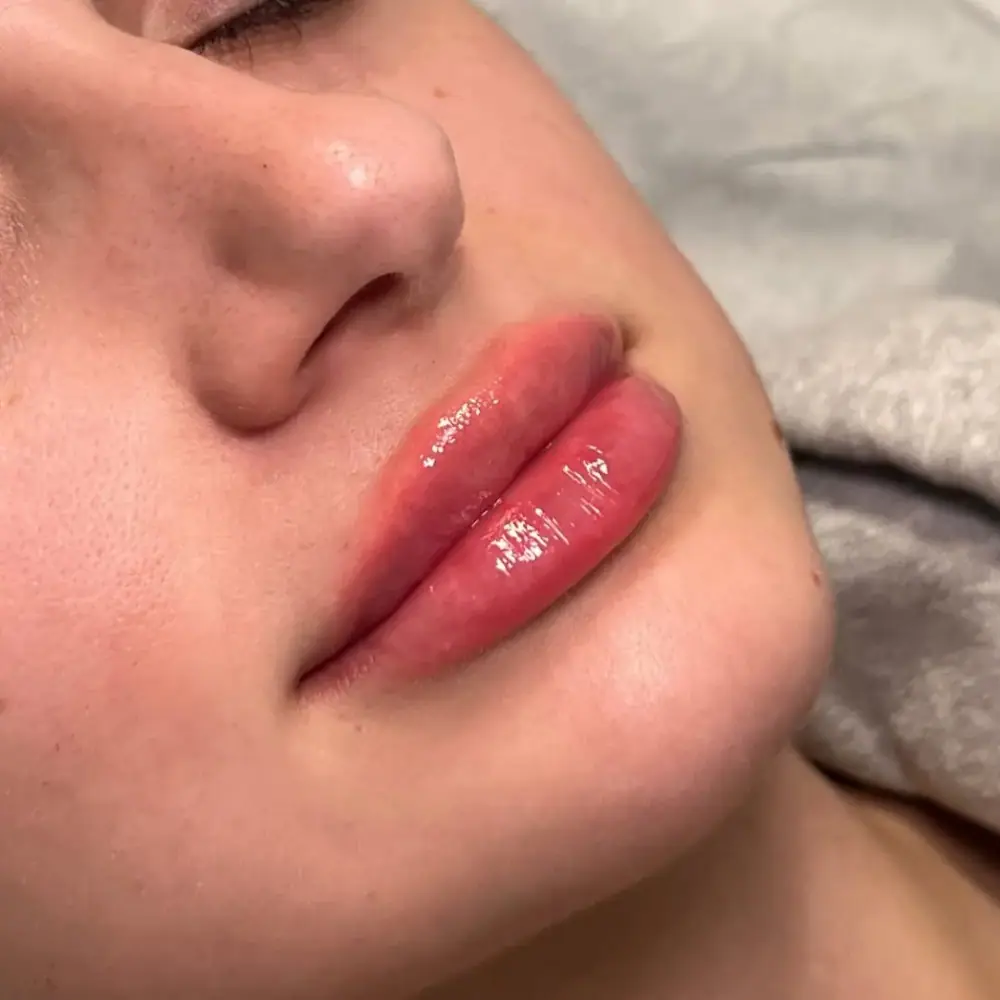 Beauty Bar Medical Clinics، عکس 2 از اینستاگرام