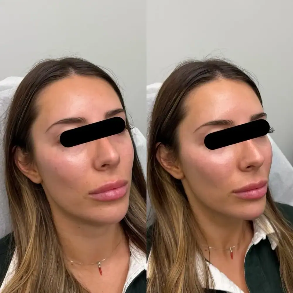 Beauty Bar Medical Clinics، عکس 4 از اینستاگرام