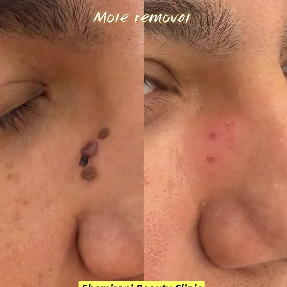Shemirani Beauty Clinic، عکس 2 از اینستاگرام