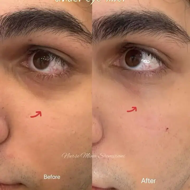 Shemirani Beauty Clinic، عکس 3 از اینستاگرام