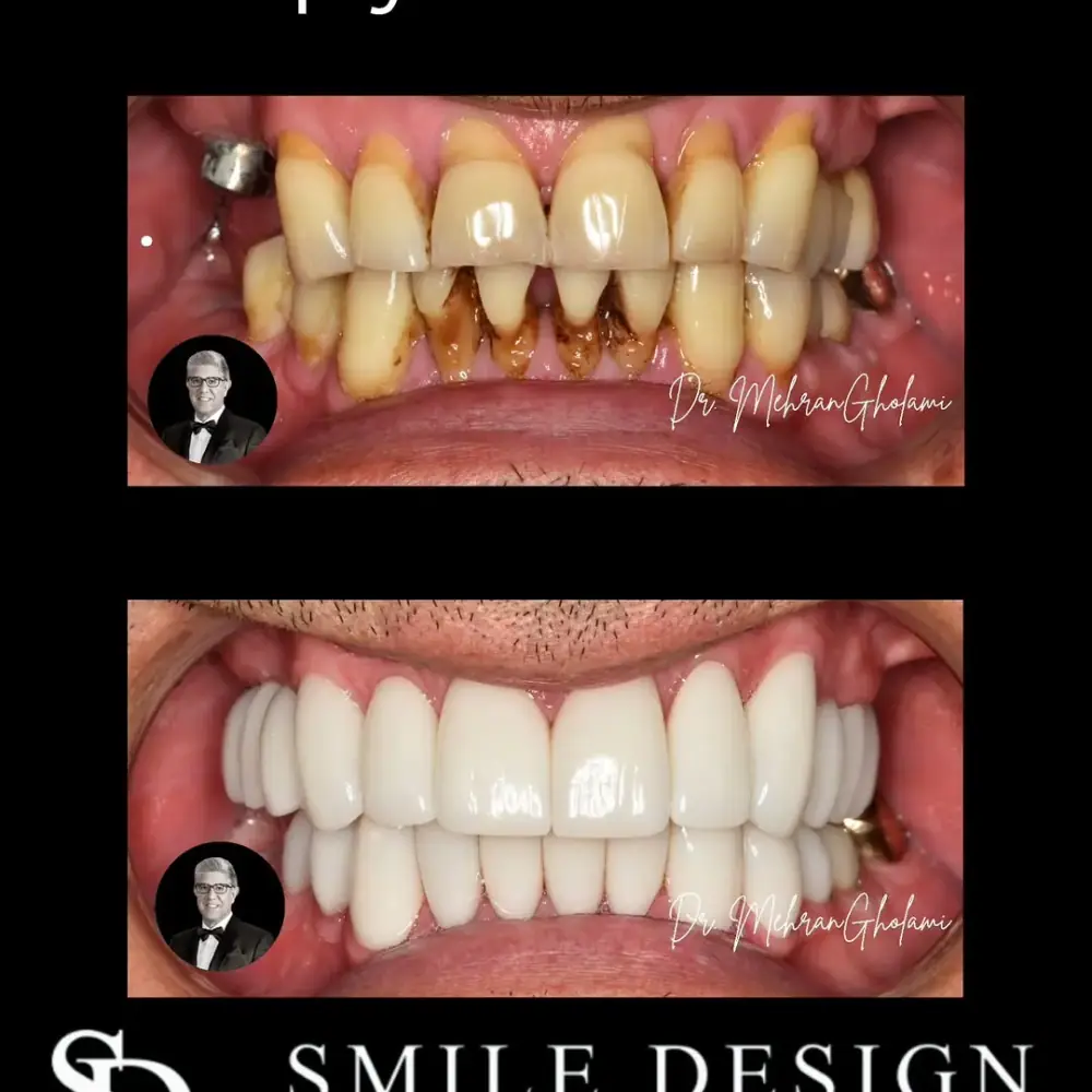 Smile Design Dental Centre، عکس 2 از اینستاگرام