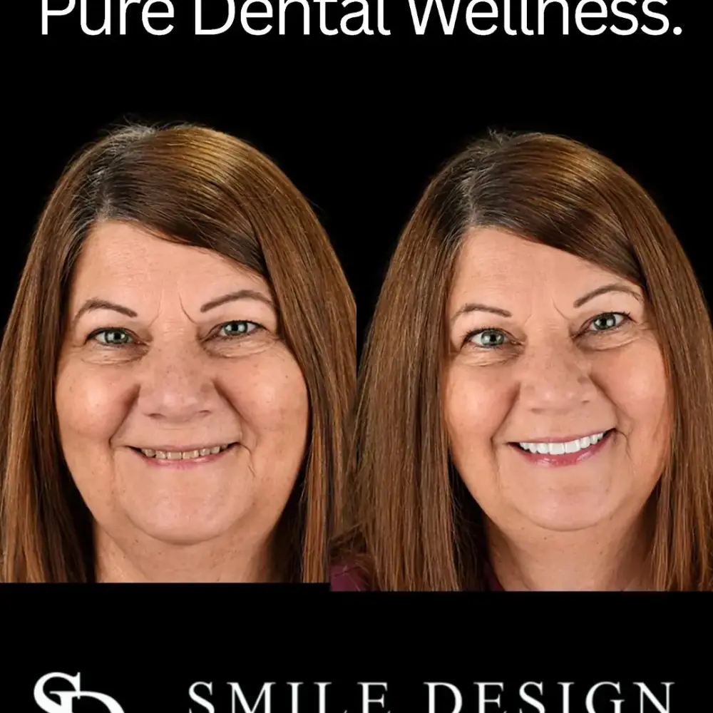 Smile Design Dental Centre، عکس 3 از اینستاگرام