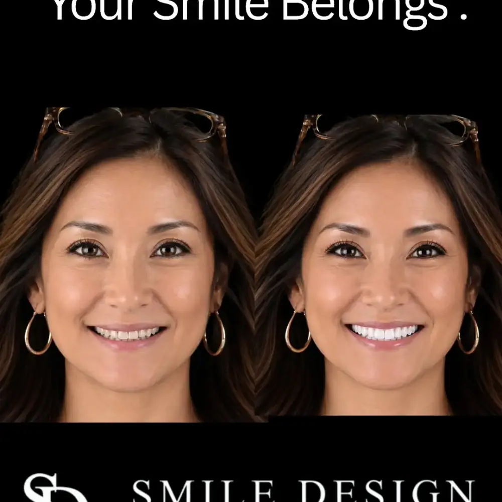 Smile Design Dental Centre، عکس 4 از اینستاگرام