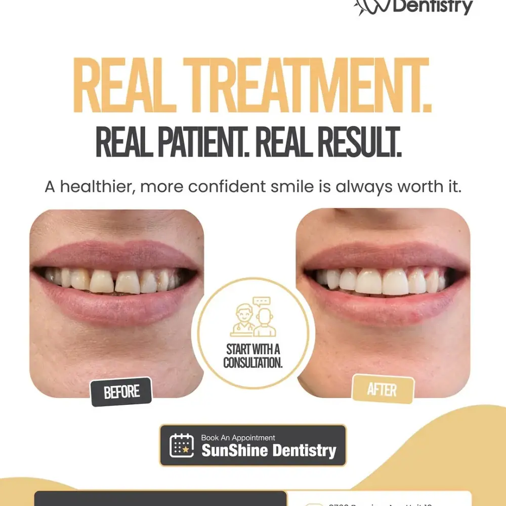 Sunshine Dentistry Clinic، عکس 4 از اینستاگرام