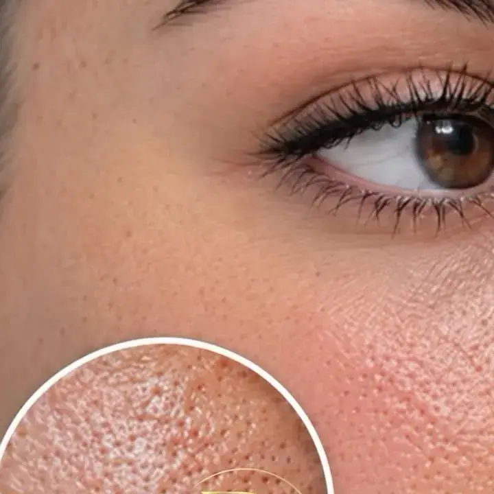 ProSkincare Clinic، عکس 3 از اینستاگرام