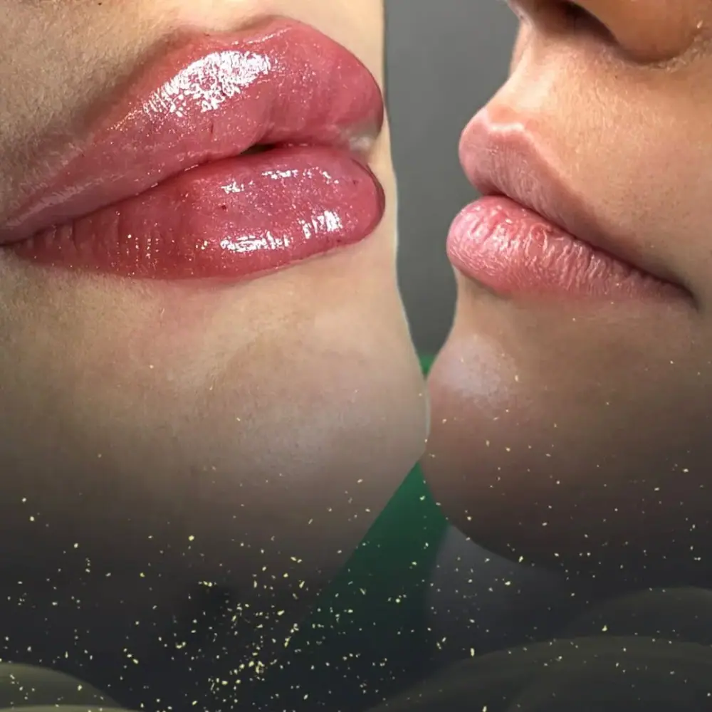 Swan medical spa، عکس 5 از اینستاگرام