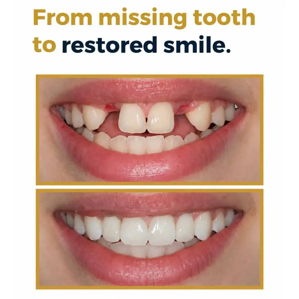 کلینیک دندان پزشکی Golden Mile Dental Clinic، عکس 5 از اینستاگرام