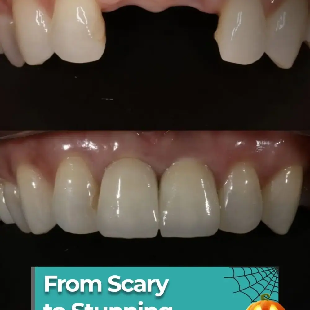 کلینیک دندان پزشکی 6006 Yonge Dental، عکس 3 از اینستاگرام