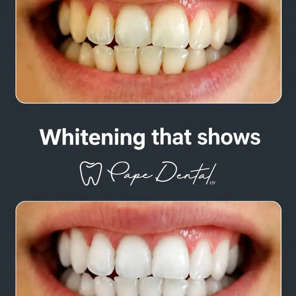 کلینیک دندان پزشکی Pape Dental Centre، عکس 3 از اینستاگرام