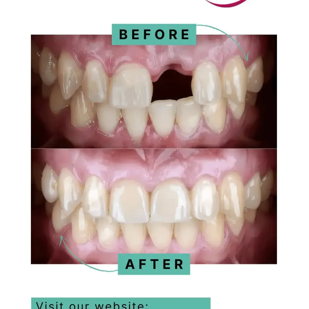کلینیک دندان پزشکی Smile Point، عکس 3 از اینستاگرام