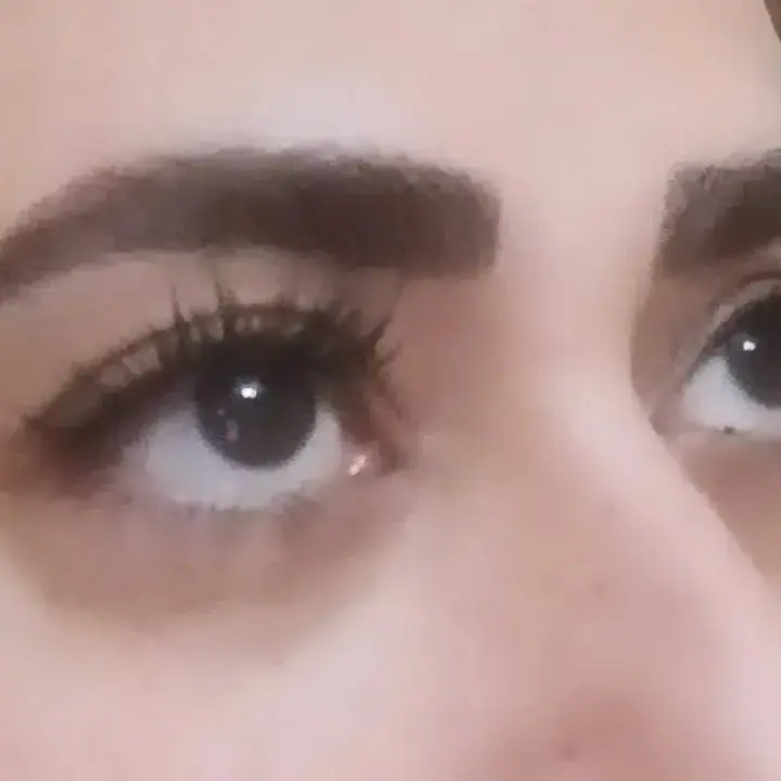 کاشت مژه هیدن sh، عکس 3 از اینستاگرام