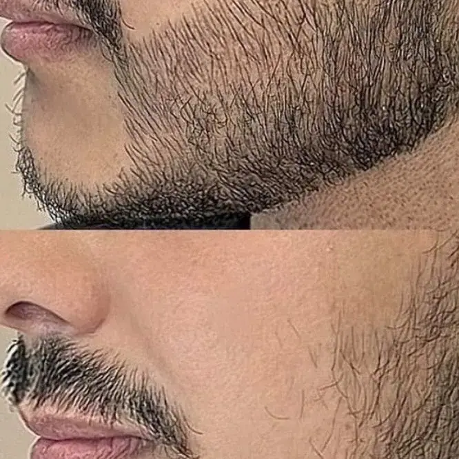 Beauty Bahar (Pigmentation Academy)، عکس 5 از اینستاگرام