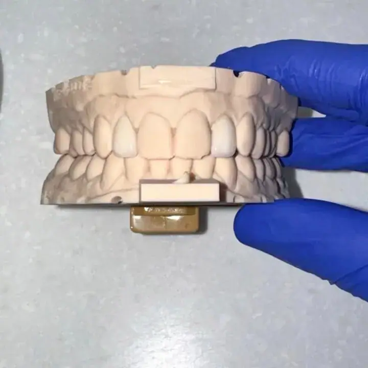 مطب دندانپزشکی، عکس 2 از اینستاگرام