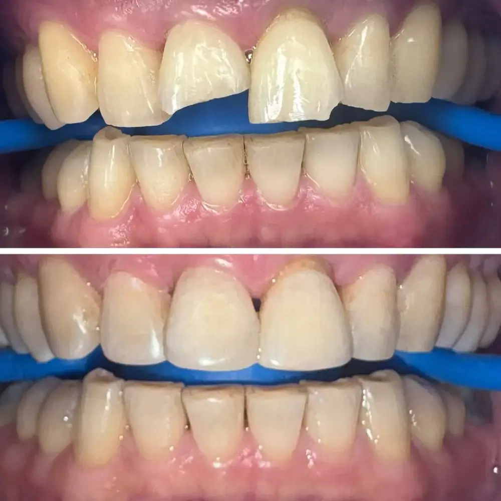 مطب دندانپزشکی، عکس 3 از اینستاگرام
